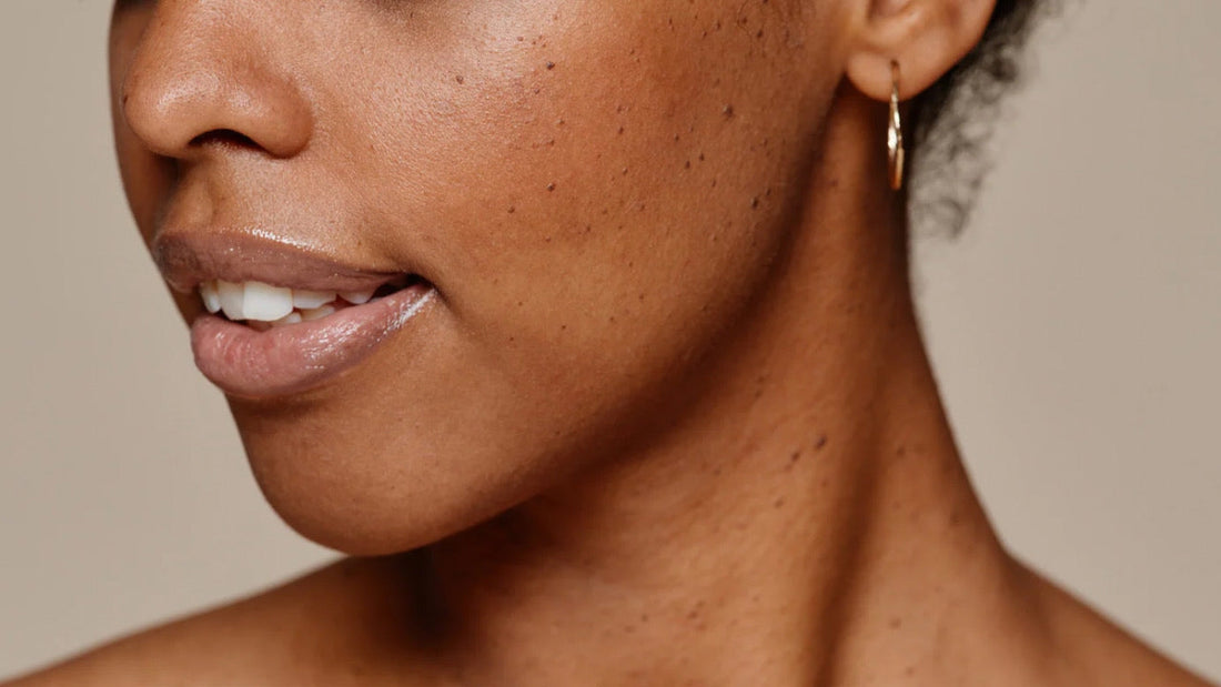 How to Repair Your Skin Barrier | 6 Tips