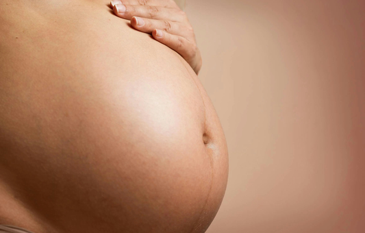 How to Prevent Stretch Marks During Pregnancy | 5 Tips